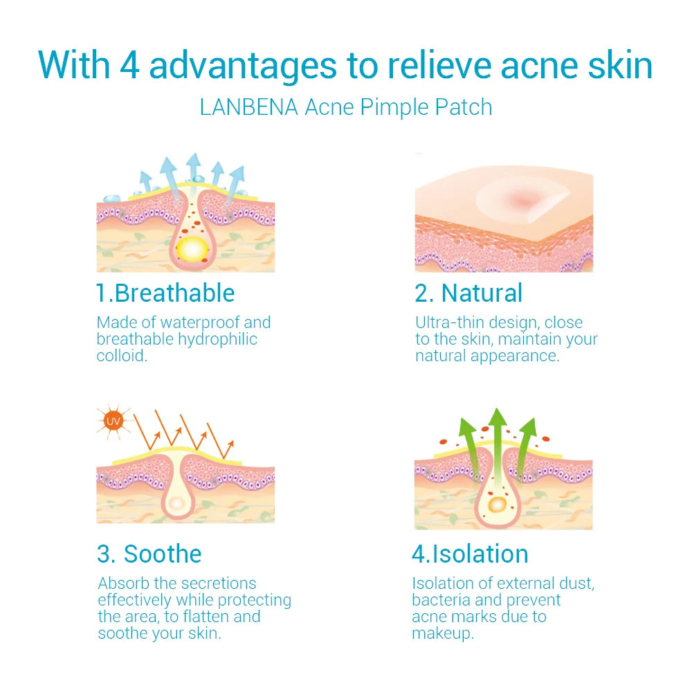 LANBENA Acne Pimple Patch Stickers